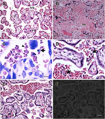 Contribution of Murine Models to the Study of Malaria During Pregnancy